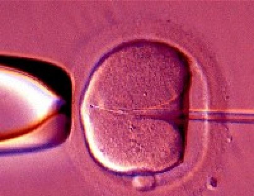 Редукция эмбриона при многоплодной. Редукция эмбриона при многоплодной беременности